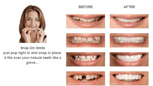 Snap On Smile Beverly Hills